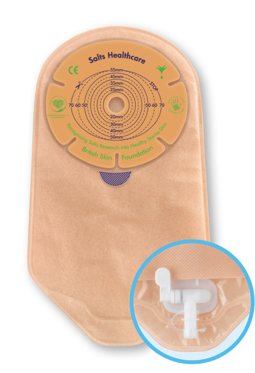 After Urostomy Surgery Your Stoma Salts Healthcare